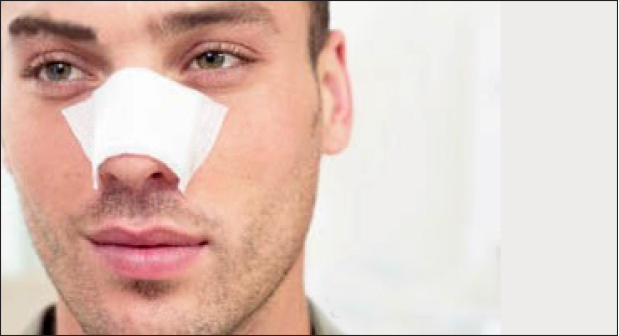 تجارت- فردا-  نشانگر جراحی پلاستیک