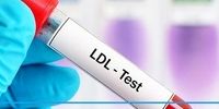 چگونه چربی خون بالا را کنترل کنیم؟