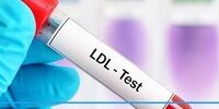 چگونه چربی خون بالا را کنترل کنیم؟