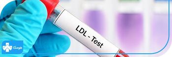 چگونه چربی خون بالا را کنترل کنیم؟