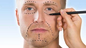 روش های لیفت صورت: از تزریق ژل تا جراحی