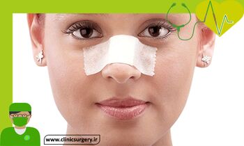قبل و بعد از جراحی بینی و گونه چه مواردی را باید در نظر گرفت؟