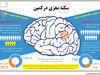 سکته مغزی در کمین