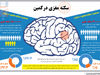 سکته مغزی در کمین